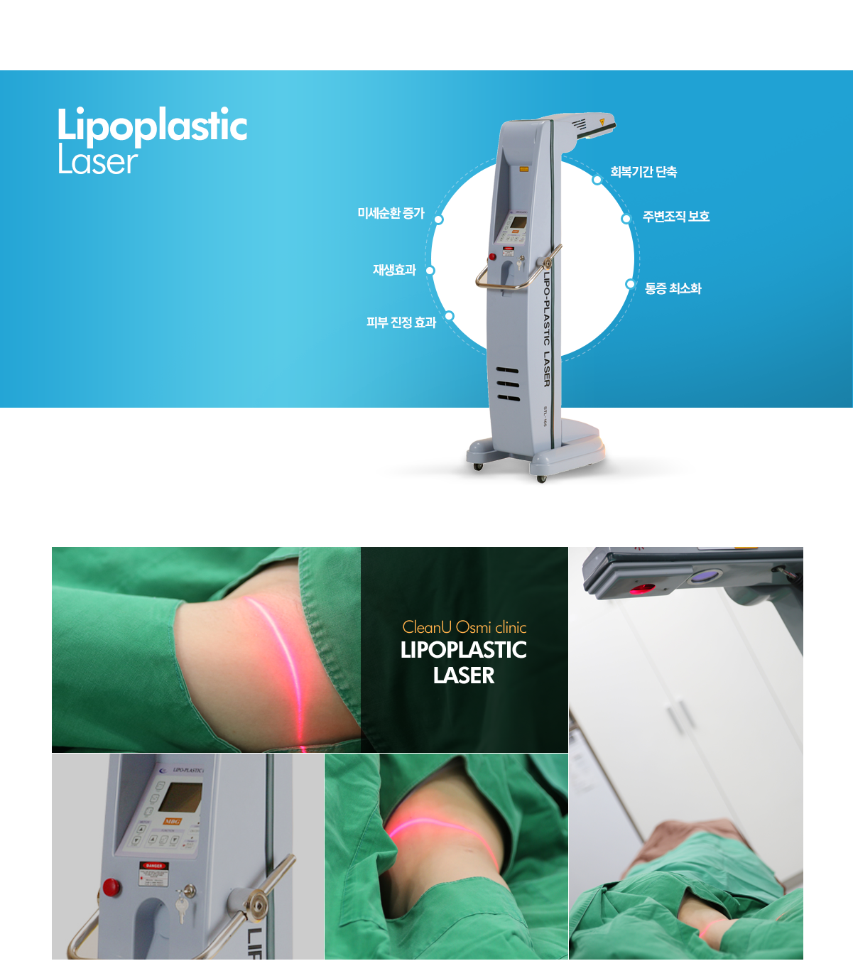 lipoplactic laser