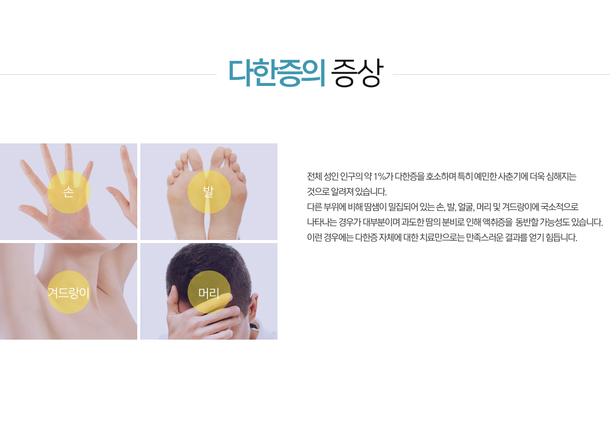 다한증의 증상