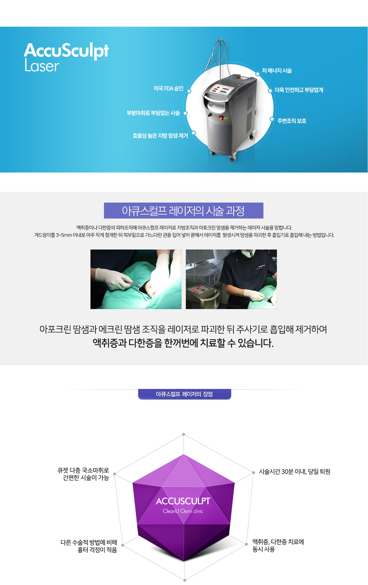 accusculpt laser 아큐스컬프 레이저의 시술 과정 아큐스컬프 레이저의 장점