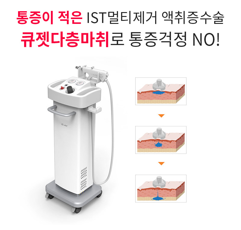 통증